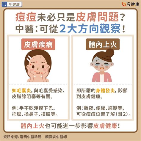 痘痘位子|青春痘、下巴痘痘長這個位置代表什麼意思？先弄懂長。